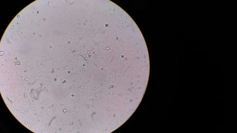 Scientists Put the Five-Second Rule to the Test — And Your Kitchen Floor Isn't Playing by Your Rules